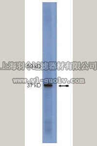 merck millipore,默克密理博,04-002,Anti-SOCS1 Antibody, clone 4H1