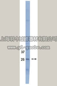 merck millipore,默克密理博,04-004,Anti-SOCS3 Antibody, clone 1B2