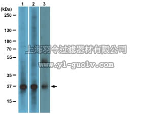 merck millipore,默克密理博,04-037,Anti-RalB Antibody, clone 25