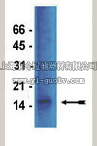 merck millipore,默克密理博,04-077,Anti-dimethyl-Histone H3 (Arg17) Antibody, rabbit monoclonal