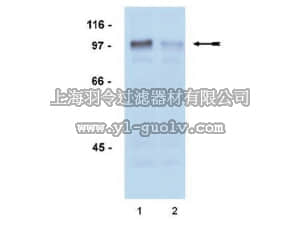 merck millipore,默克密理博,04-078,Anti-phospho-Androgen Receptor (Ser81) Antibody, rabbit monoclonal