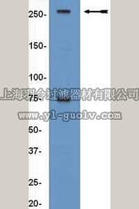 merck millipore,默克密理博,04-080,Anti-BAF250a/ARID1a Antibody, clone PSG3