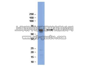 merck millipore,默克密理博,04-088,Anti-hnRNP K Antibody, clone F45P9C7