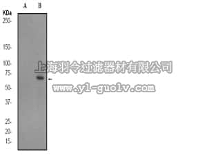 merck millipore,默克密理博,04-1000,Anti-phospho-NF-κ-B p65 (Ser536) Antibody, clone EP2294Y, rabbit monoclonal