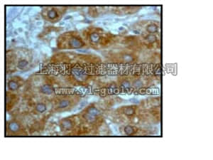 merck millipore,默克密理博,04-1006,Anti-HIF-1α Antibody, clone EP1215Y, rabbit monoclonal