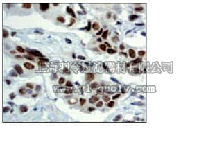 merck millipore,默克密理博,04-1007,Anti-FOXO3a Antibody, clone EP1949Y, rabbit monoclonal