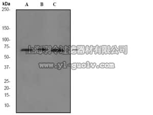 merck millipore,默克密理博,04-1008,Anti-NF-κ-B p65 Antibody, clone EP2161Y, rabbit monoclonal