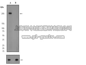 merck millipore,默克密理博,04-1009,Anti-phospho-acetyl CoA Carboxylase 1 (ACC1) (Ser79) Antibody, clone EP1885Y, rabbit monoclonal