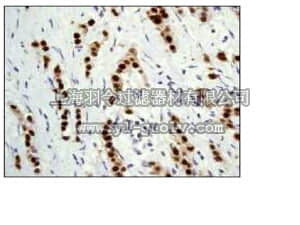 merck millipore,默克密理博,04-1018,Anti-Progesterone Receptor Antibody, clone YR85, rabbit monoclonal