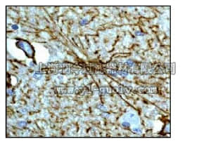 merck millipore,默克密理博,04-1031,Anti-GFAP (CT) Antibody, clone EP672Y, rabbit monoclonal
