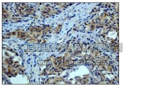 merck millipore,默克密理博,04-1035,Anti-SMAD3 Antibody, clone EP568Y, rabbit monoclonal