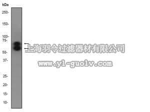 merck millipore,默克密理博,04-1048,Anti-MMP-2 Antibody, clone EP1183Y, rabbit monoclonal