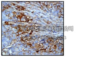 merck millipore,默克密理博,04-1049,Anti-β-Tubulin Antibody, class III (CT), clone EP1569Y, rabbit monoclonal