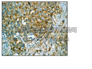 merck millipore,默克密理博,04-1051,Anti-Met (NT) Antibody, clone EP1454Y, rabbit monoclonal