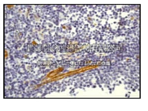 merck millipore,默克密理博,04-1060,Anti-Integrin beta3A [CD61] Antibody, clone EPR2417Y, rabbit monoclonal