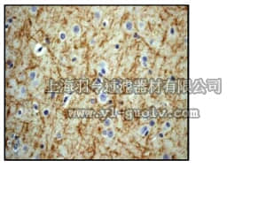 merck millipore,默克密理博,04-1061,Anti-phospho-Neurofilament M (Ser614/Ser619) Antibody, clone EPR580(2)Y, rabbit monoclonal