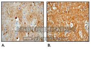 merck millipore,默克密理博,04-1062,Anti-GFAP (NT) Antibody, clone EPR1034Y, rabbit monoclonal