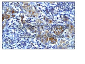 merck millipore,默克密理博,04-1063,Anti-phospho-Met (Tyr1349) Antibody, clone EP2367Y, rabbit monoclonal