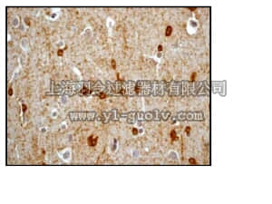 merck millipore,默克密理博,04-1064,Anti-phospho-NMDAR1(Ser889) Antibody, clone EPR2480Y, rabbit monoclonal