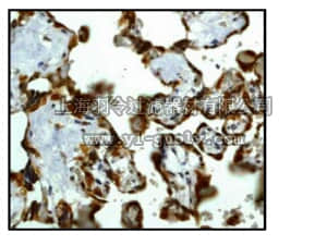 merck millipore,默克密理博,04-1069,Anti-Musashi-2 Antibody, clone EP1305Y, rabbit monoclonal