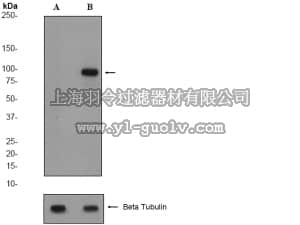 merck millipore,默克密理博,04-1070,Anti-phospho-β-Catenin(Ser33/Ser37) Antibody, clone EP742(2)Y, rabbit monoclonal