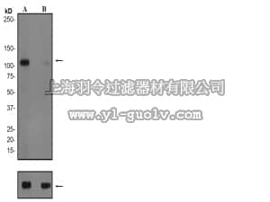 merck millipore,默克密理博,04-1073,Anti-phospho-GluR1 (Ser845) Antibody, clone EPR2148, rabbit monoclonal