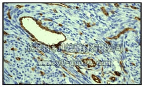 merck millipore,默克密理博,04-1074,Anti-PECAM-1 [CD31] Antibody, clone EP3095, rabbit monoclonal