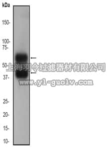 merck millipore,默克密理博,04-1079,Anti-Calcium/Calmodulin Kinase II Antibody, clone EP1829Y, rabbit monoclonal