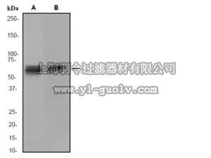 merck millipore,默克密理博,04-1081,Anti-Calcium/Calmodulin Kinase IV Antibody, clone EP2564Y, rabbit monoclonal