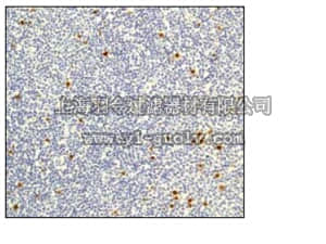 merck millipore,默克密理博,04-1093,Anti-phospho-Histone H3 (Ser10) Antibody, clone E173, rabbit monoclonal