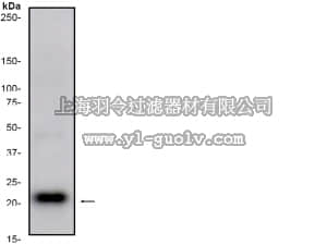 merck millipore,默克密理博,04-1095,Anti-IL-6 Antibody, clone E457, rabbit monoclonal