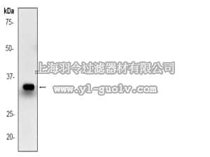 merck millipore,默克密理博,04-1099,Anti-C/EBP β (NT) Antibody, clone E298, rabbit monoclonal