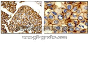 merck millipore,默克密理博,04-1103,Anti-E-cadherin Antibody, clone EP700Y, rabbit monoclonal