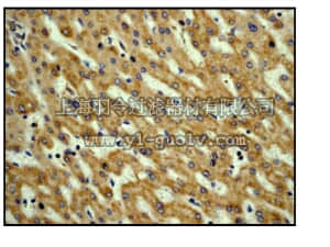 merck millipore,默克密理博,04-1108,Anti-Vitronectin Antibody, clone EP873Y, rabbit monoclonal