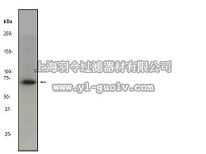 merck millipore,默克密理博,04-1112,Anti-Neurofilament-L (CT) Antibody, clone EP675Y, rabbit monoclonal