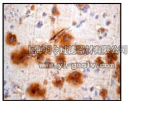 merck millipore,默克密理博,04-1119,Anti-NGF-β (CT) Antibody, clone EP1320Y, rabbit monoclonal