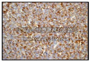 merck millipore,默克密理博,04-1121,Anti-ROCK-1 Antibody, clone EPR638Y, rabbit monoclonal
