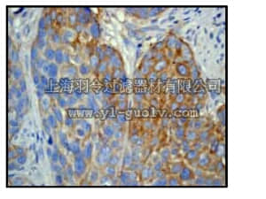 merck millipore,默克密理博,04-1122,Anti-MMP-1 Antibody, clone EP1247Y rabbit monoclonal