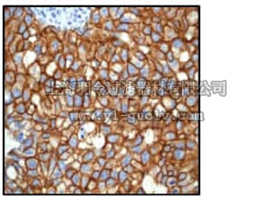 merck millipore,默克密理博,04-1127,Anti-ErbB2/Her2 Antibody, clone EP1045Y, rabbit monoclonal