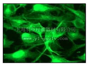 merck millipore,默克密理博,04-1128,Anti-Casein Kinase II (beta subunit) Antibody, clone EP1995Y, rabbit monoclonal