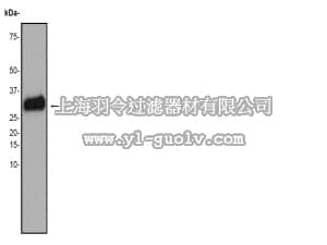 merck millipore,默克密理博,04-1133,Anti-TIMP-1 Antibody, clone EP1549RY, rabbit monoclonal