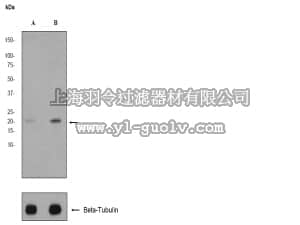 merck millipore,默克密理博,04-1138,Anti-phospho-4E-BP1 (Ser65) Antibody, clone EP353(2)Y, rabbit monoclonal