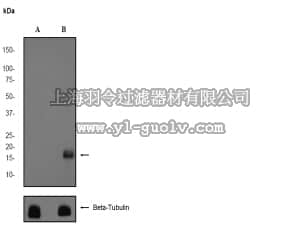 merck millipore,默克密理博,04-1139,Anti-phospho-4E-BP1 (Thr70) Antibody, clone EPR654(2)AY, rabbit monoclonal