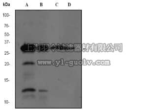 merck millipore,默克密理博,04-1142,Anti-pro-NGF (NT) Antibody, clone EP1318Y, rabbit monoclonal
