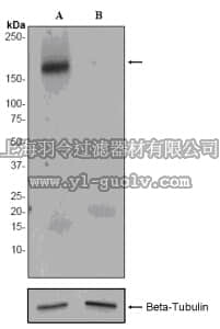 merck millipore,默克密理博,04-1144,Anti-phospho-Her4/ErbB-4 (Tyr1258) Antibody, clone EP2272AY, rabbit monoclonal
