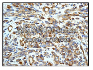 merck millipore,默克密理博,04-1147,Anti-MCAM [CD146] Antibody, clone EPR3208, rabbit monoclonal