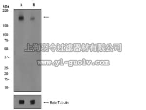 merck millipore,默克密理博,04-1148,Anti-phospho-NMDAR2B (Ser1303) Antibody, clone EP1858Y, rabbit monoclonal