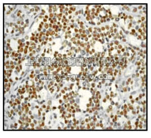merck millipore,默克密理博,04-1151,Anti-Cyclin D1 Antibody, clone EPR2241(IHC)-32, rabbit monoclonal