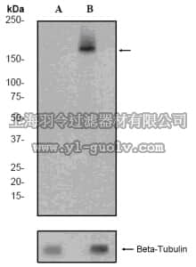 merck millipore,默克密理博,04-1156,Anti-phospho-PDGF Receptor β (Tyr740) Antibody, clone EP2135Y, rabbit monoclonal