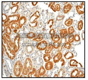 merck millipore,默克密理博,04-1158,Anti-Calcium/Calmodulin Kinase I Antibody, clone EPR2217Y, rabbit monoclonal